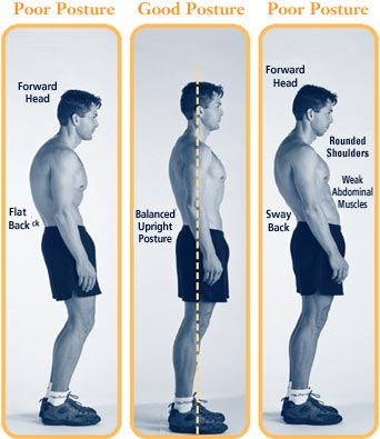 Back Pain Posture